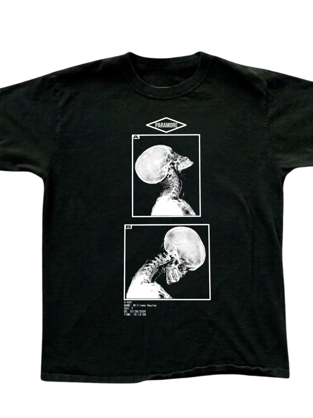 Gildan Black Tee with White Skull X-Ray Graphics, Gift For Her, For Him
